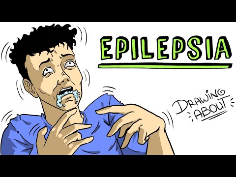 Video: Cómo prevenir la epilepsia (con imágenes)