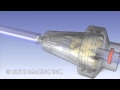 Loading Heart Valve Catheter - Medical & Scientific Video Production