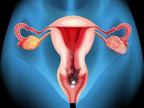 How Yoni Pearls Detox Work