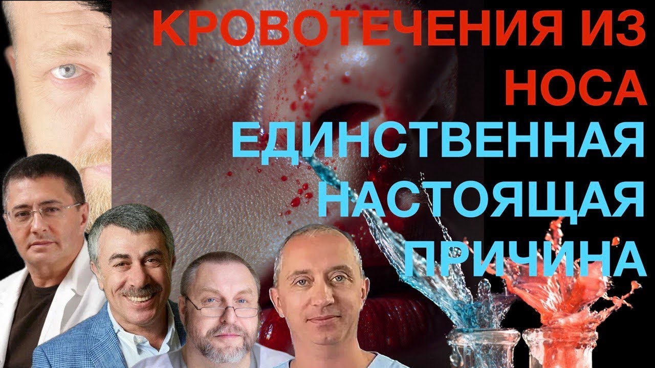 Носовые кровотечения и их истинная первопричина — физика сообщающихся сосудов