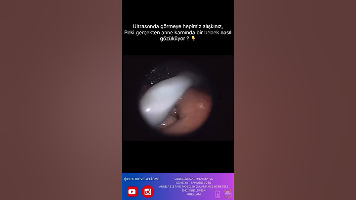 Ultrasonda görmeye hepimiz alışkınız, peki gerçekten anne karnında bir bebek nasıl gözüküyor? 😍😱
