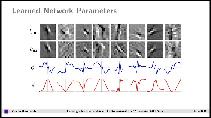 Kerstin Hammernik: Learning a Variational Network for Reconstruction of Accelerated MRI Data