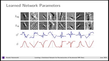 Kerstin Hammernik: Learning a Variational Network for Reconstruction of Accelerated MRI Data