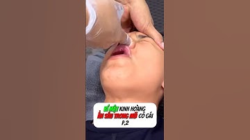 [P.2] Bên trong mũi cô gái là thứ này #shorts
