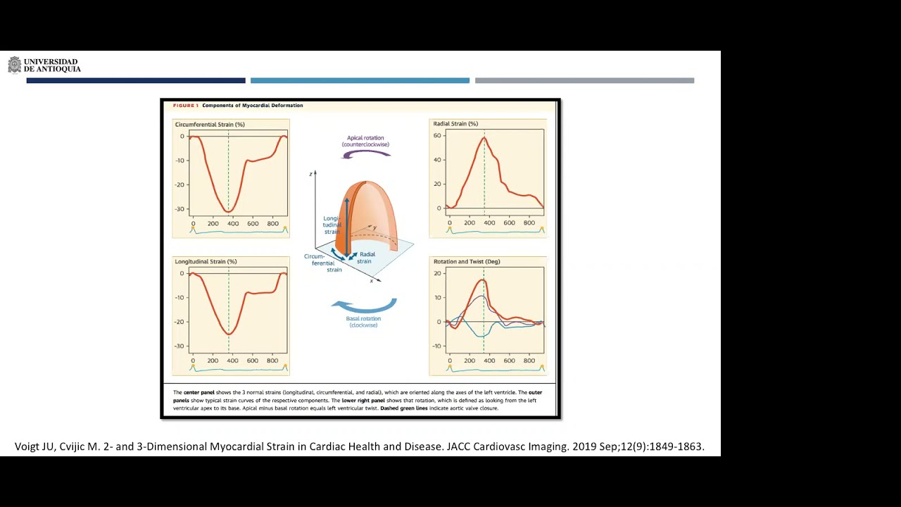 Strain longitudinal en cardioncologia