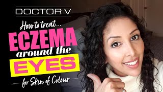 Doctor V - How To Treat Eczema around the Eyes for Skin of Colour | Black or Brown Skin