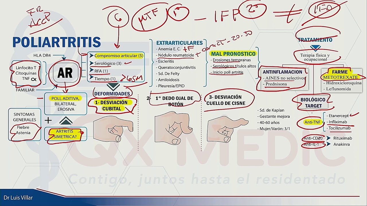 Poliartritis - Mapa mental - Dr. Luis Villar
