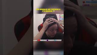 Is My Forehead Big?😭 #forehead #big #twitch #clips #yt #shorts #ytshorts #viralvideo #fyp