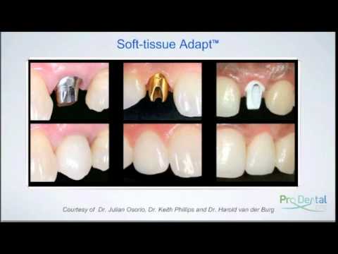 Atlantis dental implant abutment webinar