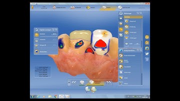 CEREC SW 4.6