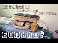 Как делают иглоукалывание в Китае//Китайская народная медицина//Chinese traditional medicine