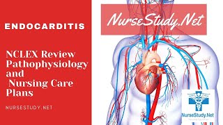 Endocarditis Nursing NCLEX Pathophysiology Care Plan for Nursing Students