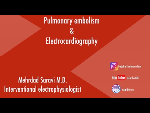 آموزش نوار قلبی