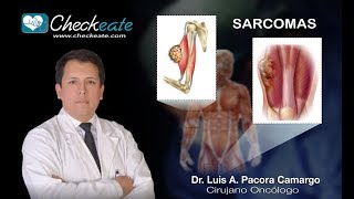 Sarcomas, neoplasias of supportive and connective tissue (connective tissue)
