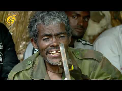 ቪዲዮ: ያልተገናኘ ሃይፐርቢሊሩቢኔሚያ ዋና መንስኤ የቱ ነው?