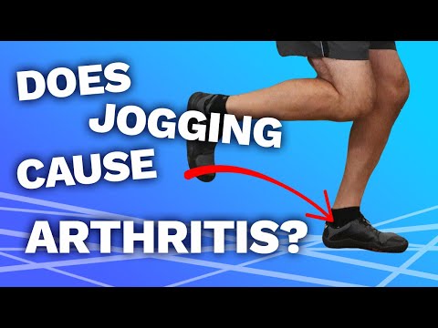 Does jogging cause arthritis?(You Won't Believe The Answer!)