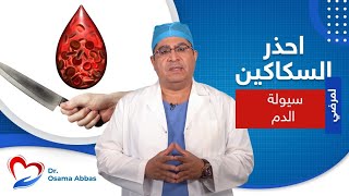 تحذير لمرضى سيولة الدم من استخدام السكاكين | دكتور اسامة عباس