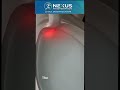 TYPE 3 SLAP TEAR IN SHOULDER #shoulderinjury #shoulderpain #shoulderdislocation #shoulder #cristmas
