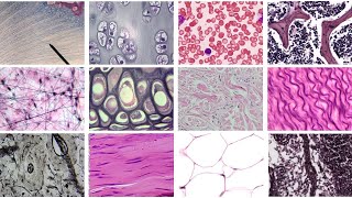 Practice Identifying Connective Tissue (Complete)