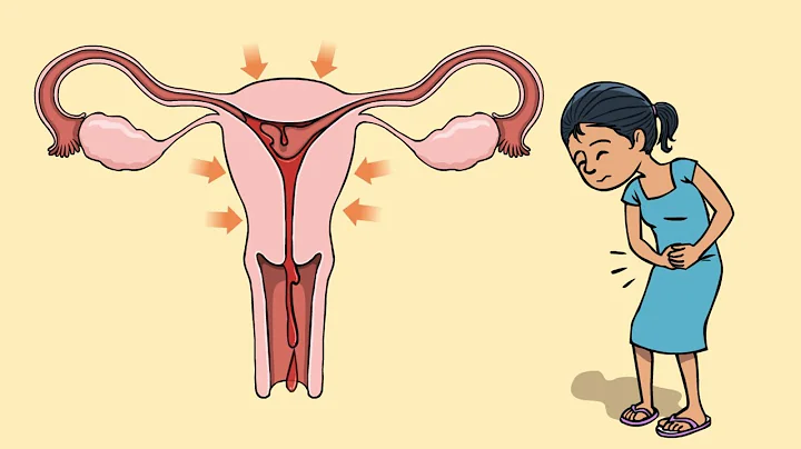 What are period cramps and how to deal with them? - DayDayNews