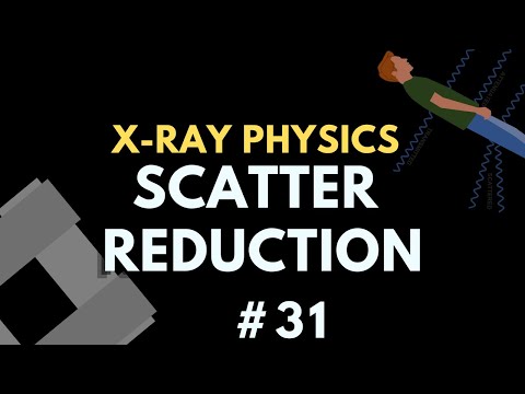 Scatter Reduction | X-ray Physics | Radiology Physics Course #38