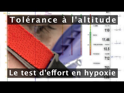 Vidéo: En quoi la force d'effort est-elle mesurée ?