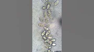 Exploring the Microbial Universe Within: Bacteria