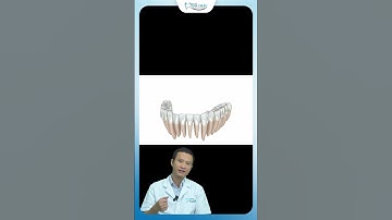 Niềng Răng Khấp Khểnh Bằng Invisalign | Bác Sĩ Yên