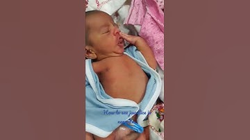 How a Paediatrician check jaundice clinically in neonates.