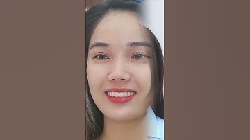 Cắt Mí Dưới: Giải Pháp Xóa Tan Quầng Mắt Nặng Nề, Mang Lại Sự Tươi Trẻ| Viện Thẩm Mỹ Quốc Tế VIOLA