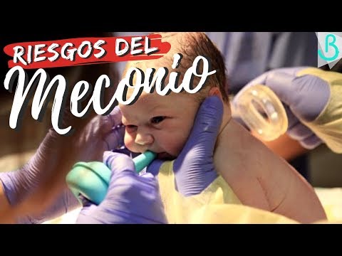 Vídeo: ¿Los Bebés Defecan En El útero Y Otros Hechos?