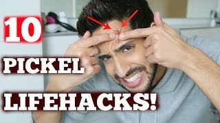 10 KRASSE PICKEL Lifehacks!