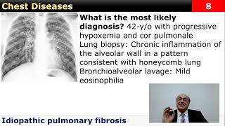USMLE Step 2 ’Quiz’ Review (Flash Cards) [Chest Diseases] – Electronic Quick Review Books (12 Books) screenshot 4
