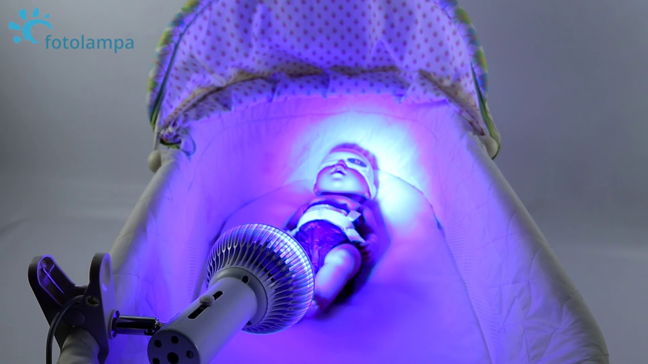 Желтуха новорожденного. Обзор лампы для лечения желтухи новорожденного