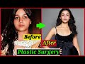 Bollywood Starskids Who Had Plastic Surgery To Look Beautiful | Alia Bhatt , Sara Ali Khan , Janhvi