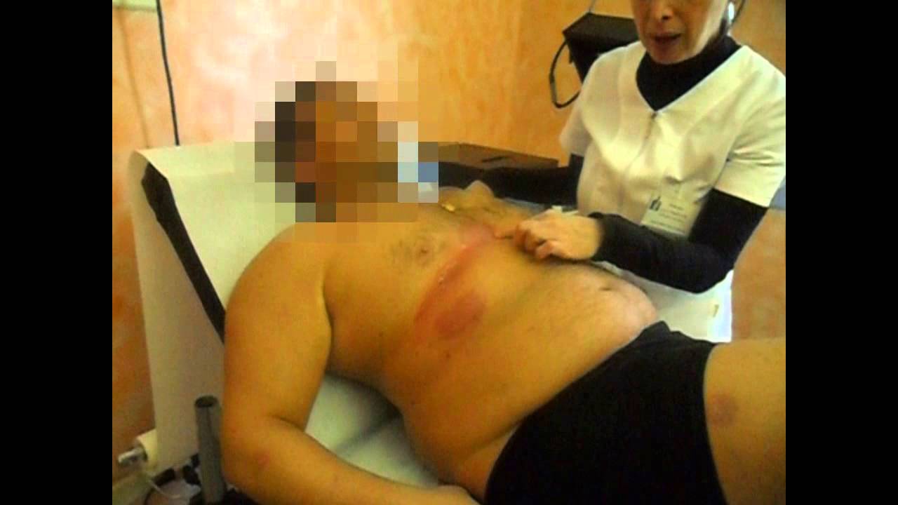 La crema di certificato da psoriasi