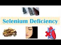 Selenium Deficiency | Dietary Sources, Causes, Signs & Symptoms (Infertility), Diagnosis, Treatment