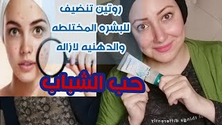 غسول للبشره الدهنيه وازاله الحبوبLotion for combination and oily skin and clearing pimples