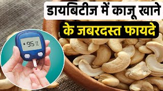 Diabetes Patients के लिए Cashews खाने के जबरदस्त फायदे, जाने क्या है खाने का सही तरीका | Boldsky