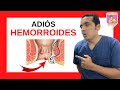 ¿CÓMO DECIRLE ADIÓS A LAS HEMORROIDES? - Dr. ELmer H. Luna Vilchez