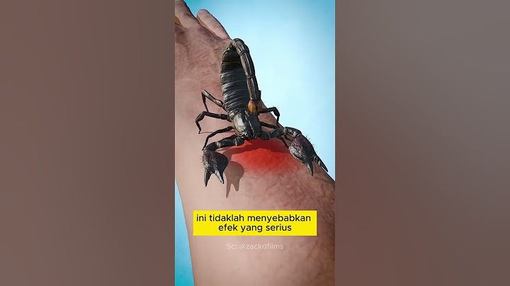 Begini yang terjadi ketika kamu disengat oleh kalajengking | Bantu support dengan klik subscribe yaa