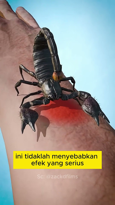 Begini yang terjadi ketika kamu disengat oleh kalajengking | Bantu support dengan klik subscribe yaa
