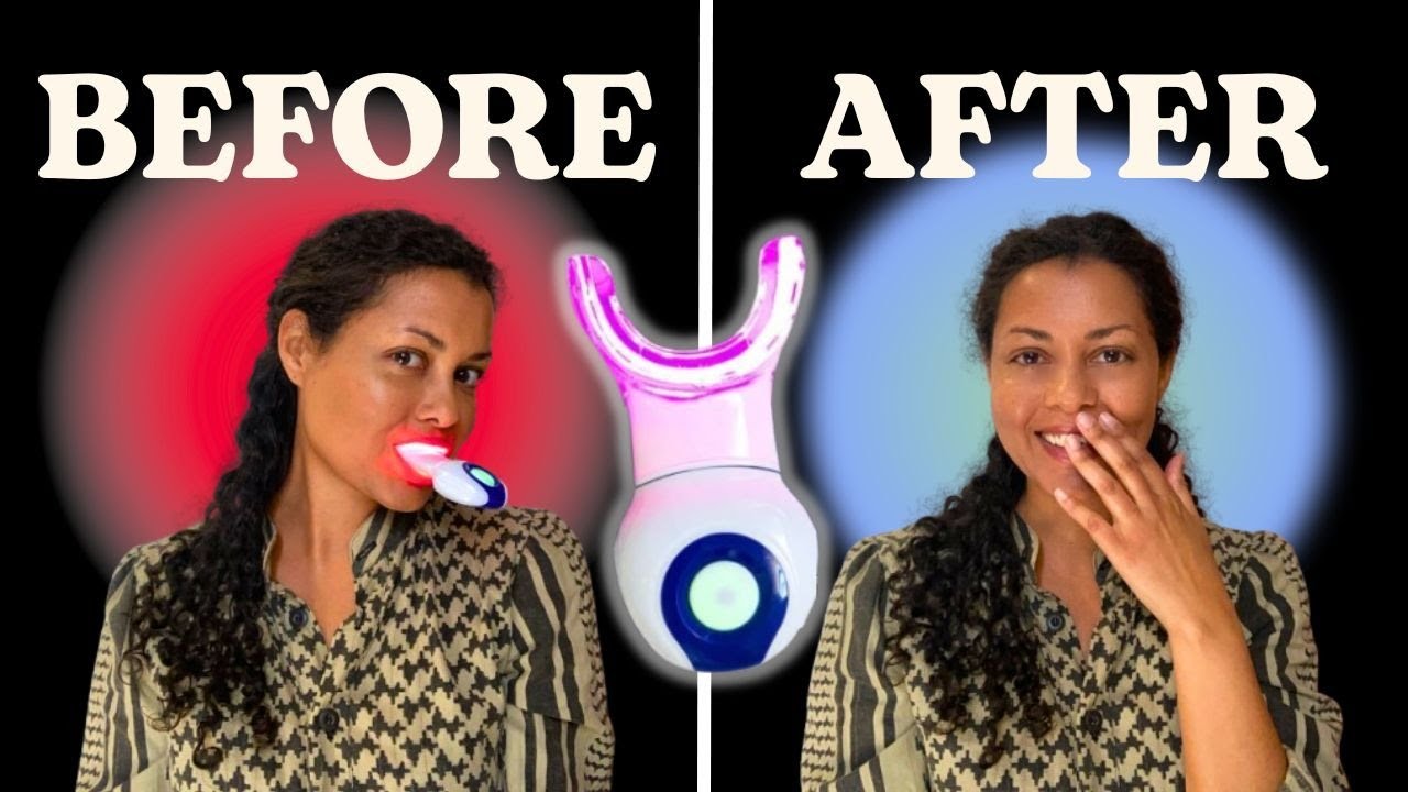 Does the dpl Oral Red Light Therapy Device Actually Work? 30-Day Test ...