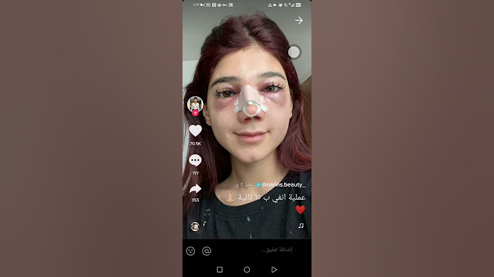 عملية أنف نارين بيوتي بي ١٥ ثانية بس ❤️🌹شوفوا كيف تغيرت