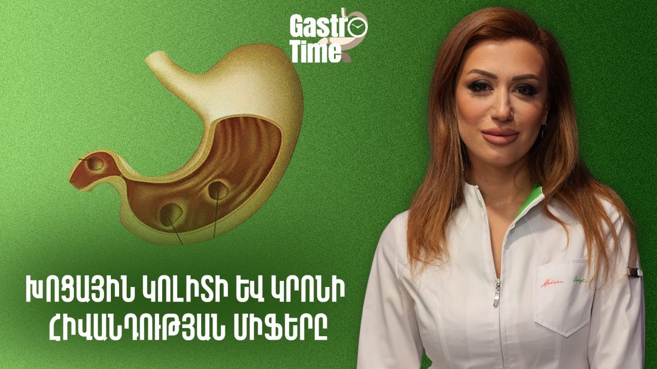 Խոցային կոլիտի և կրոնի հիվանդության միֆերը | GastroTime 95