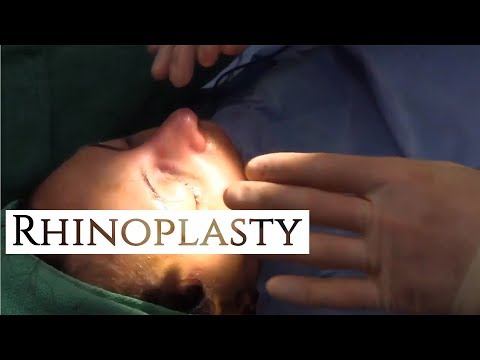 Rhinoplasty |  Nose Job | Plastic Surgery | Beverly Hills | Dr. Daniel Barrett
