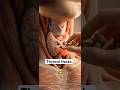 Thyroid Hacks