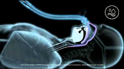 ResMed AirSense 10 CPAP Humidification Features