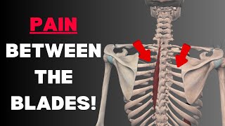 The Missing Link in Shoulder Pain Rehab [Science Based]