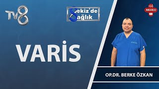 Varislerin Oluşması Nelere Bağlıdır? | Op. Dr. Berke Özkan | 8'de Sağlık